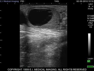 Equine veterinary ultrasound images