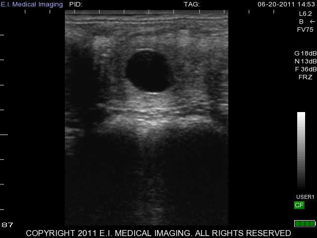 Equine 15 day pregnancy
